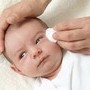 baby-eczema baby-eczema