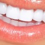 woman teeth woman teeth